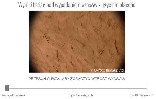TRX2 – tabletki na porost włosów