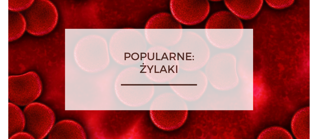 BioTrendy - Popularne - Żylaki