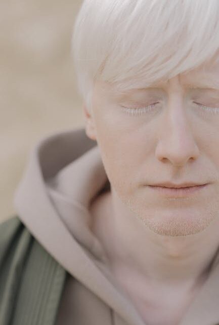 BioTrendy - Czy można leczyć bielactwo