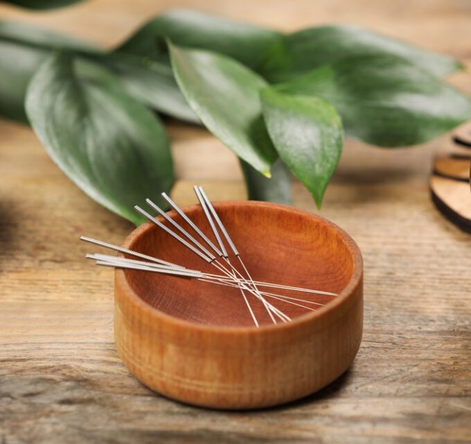 BioTrendy - Akupunktura jako terapia medyczna