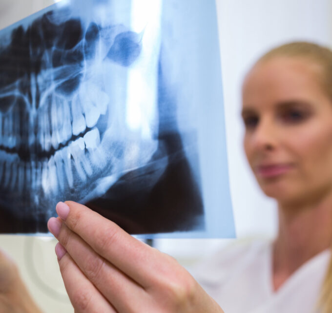 BioTrendy - Na czym polega rentgen zębów